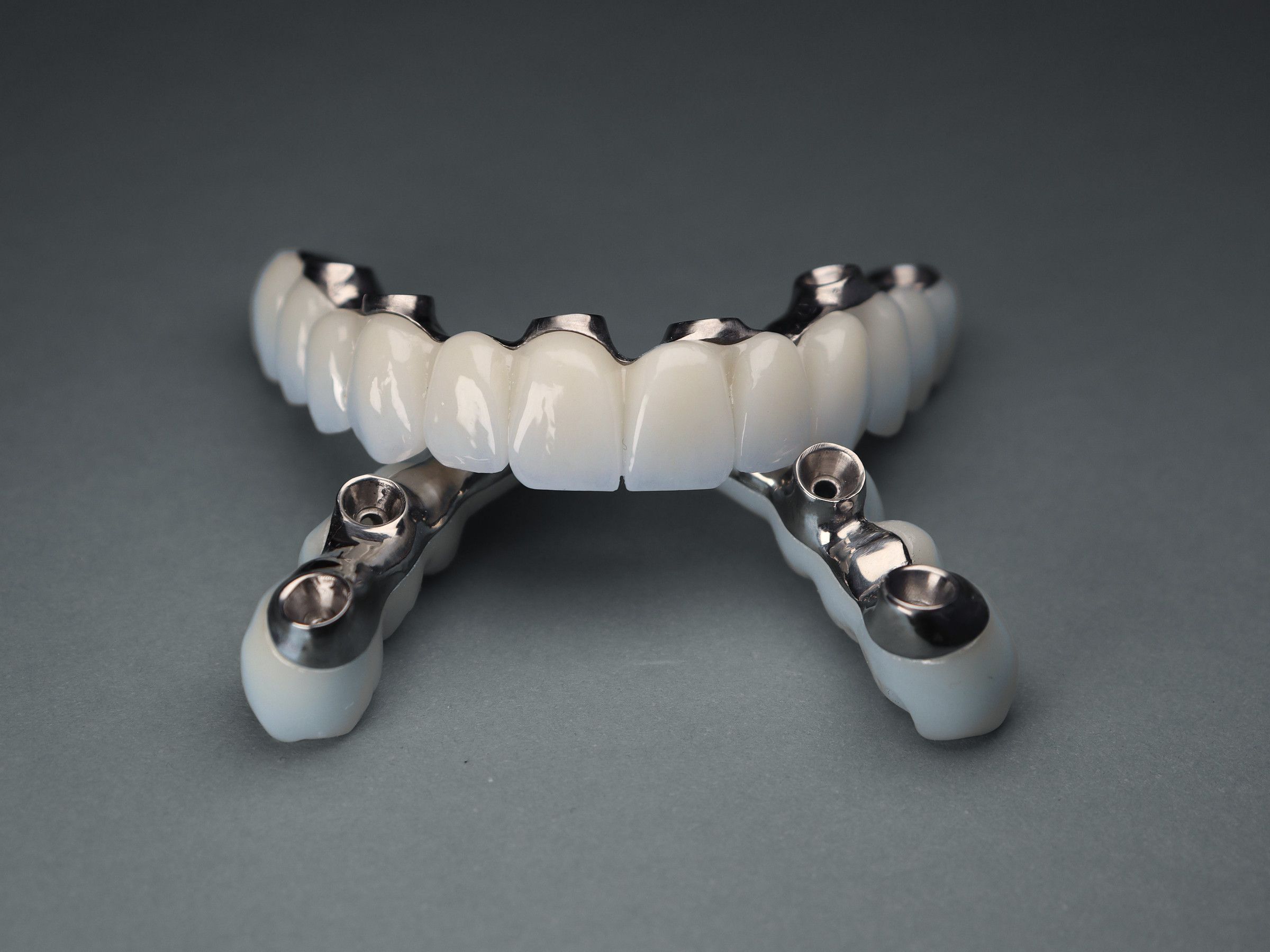 An implant-supported full-arch bridge on its titanium framework